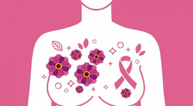cancer de mama 1