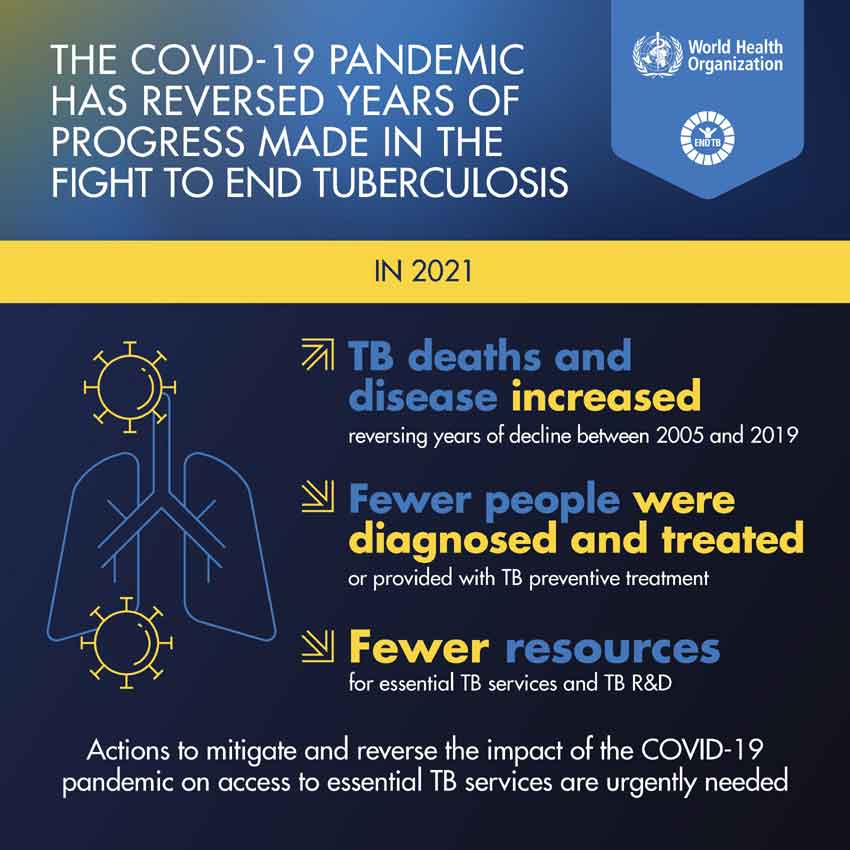 TB imorbidity rose dueto the COVID-19 pandemic