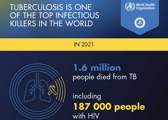 Nearly 10.6 million people contracted tuberculosis in 2021, 4.5 percent more than in 2020