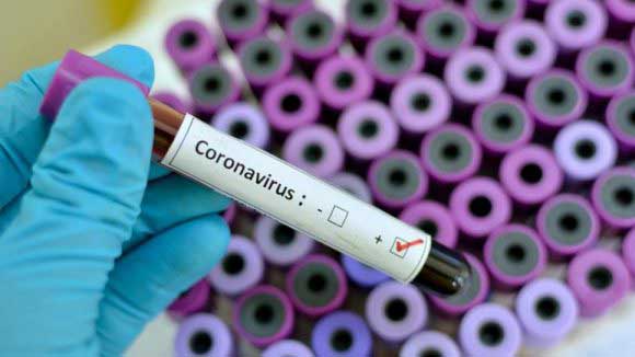 The province of Las Tunas is inserted in a population study to detect possible infections with the SARS-CoV-2 coronavirus