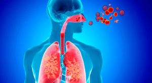Acute respiratory infections in the spotlight in Las Tunas.