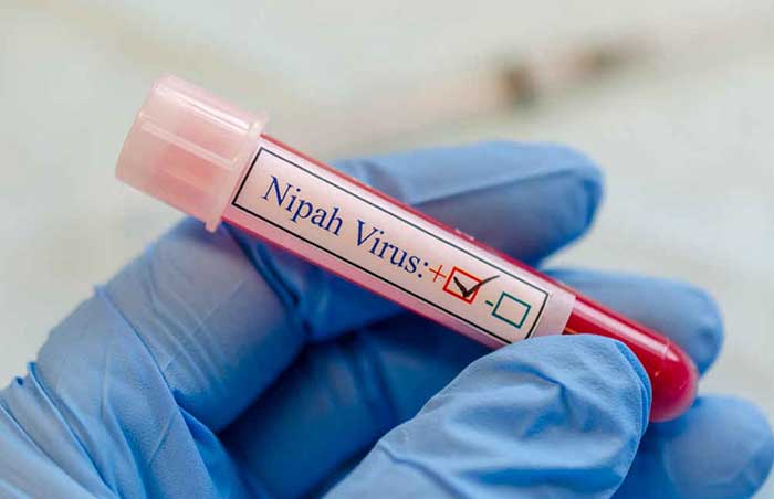 La infección por el virus del Nipah puede presentarse de manera asintomática o en sus casos más graves ocasionar trastorno respiratorio agudo y encefalitis fatal
