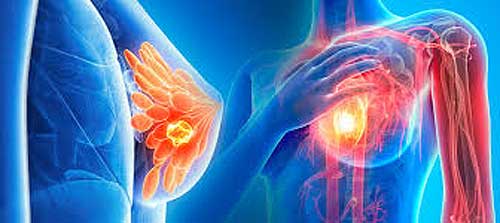 Malignant tumors, diseases associated with the heart and strokes are the leading causes of death in Las Tunas