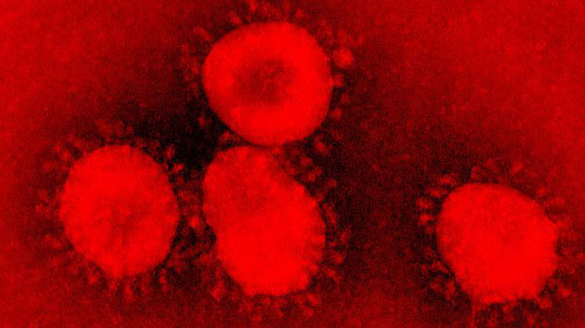 The third positive case for Covid-19 